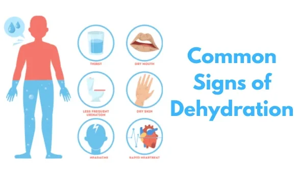 Common Signs of Dehydration