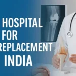 Best Hospitals for Knee Replacement in India