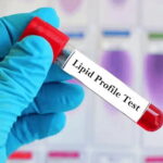 Lipid Profile Tests