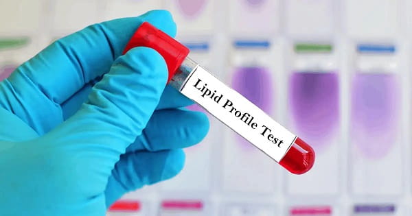 Lipid Profile Tests